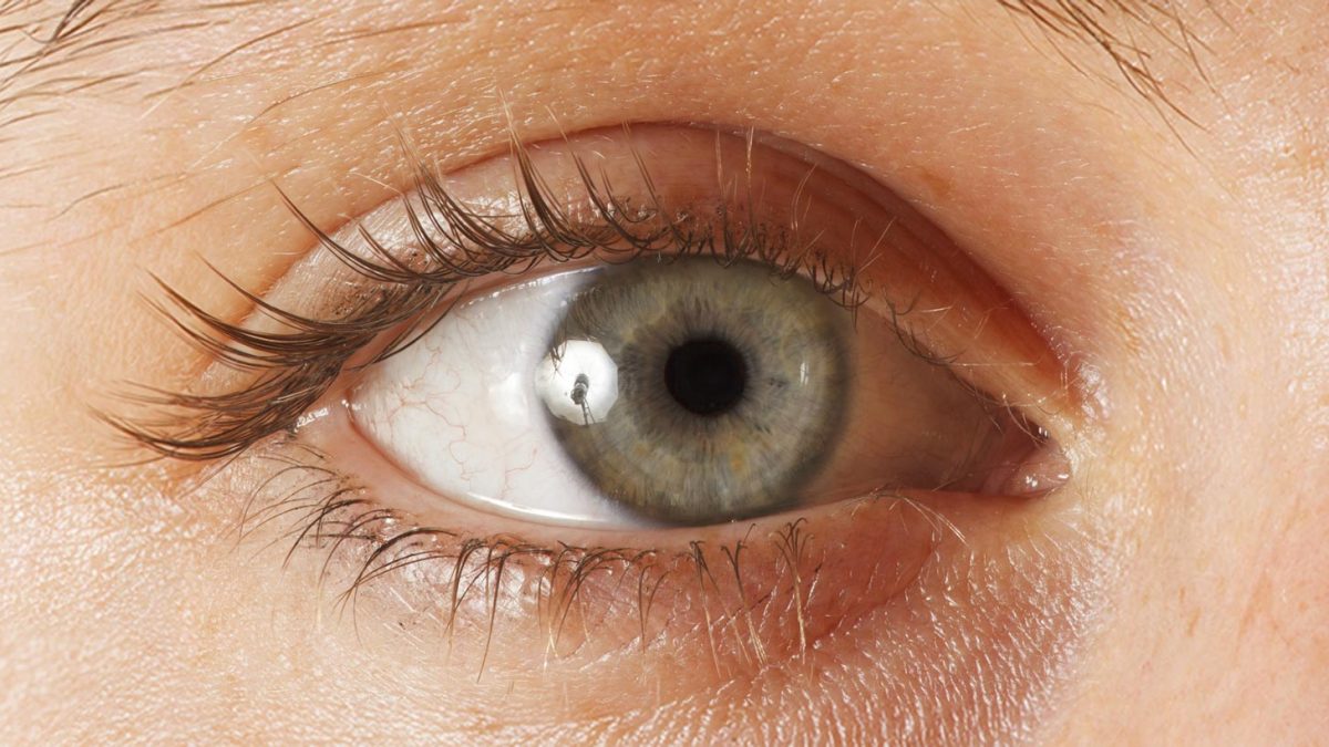 oeil